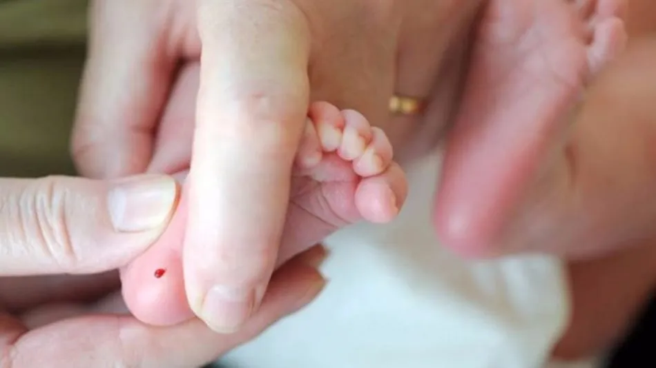 Prueba del talón en un recién nacido