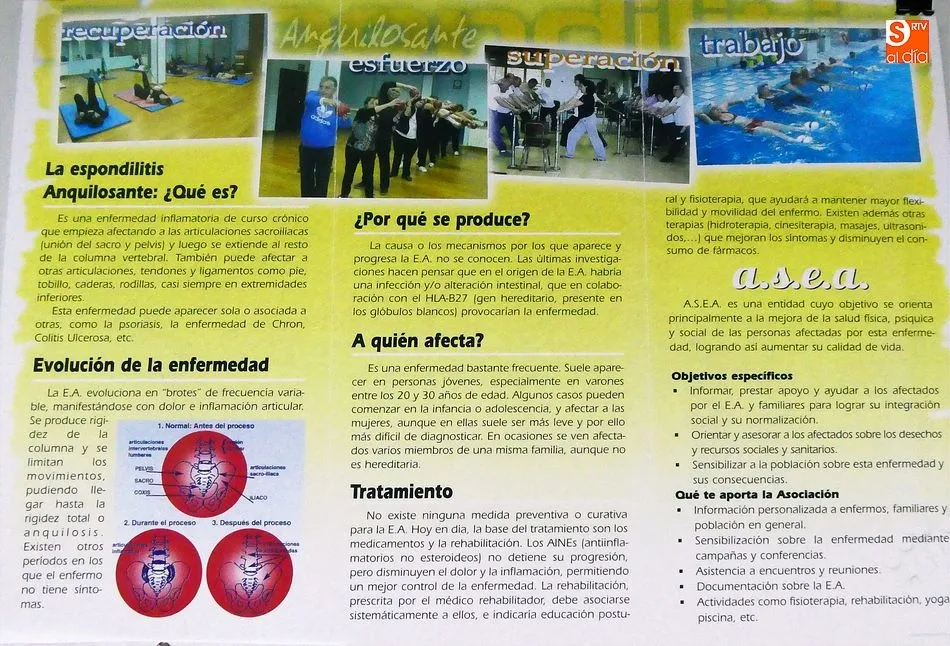 Foto 6 - Espondilitis, una enfermedad usurpadora de movilidad y de sue&ntilde;os