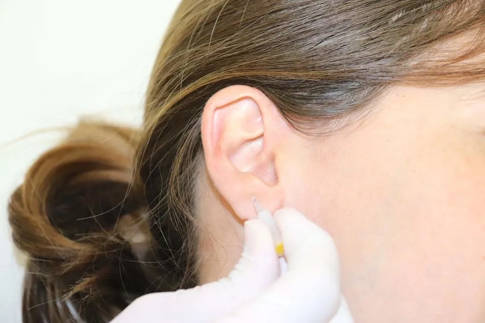 Tratamiento de acupuntura frente al Párkinson y otras enfermedades neurodegenerativas  