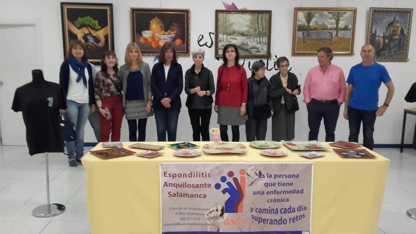 El actor Adrián Lastra apoya a las personas afectadas por Espondilitis Anquilosante  