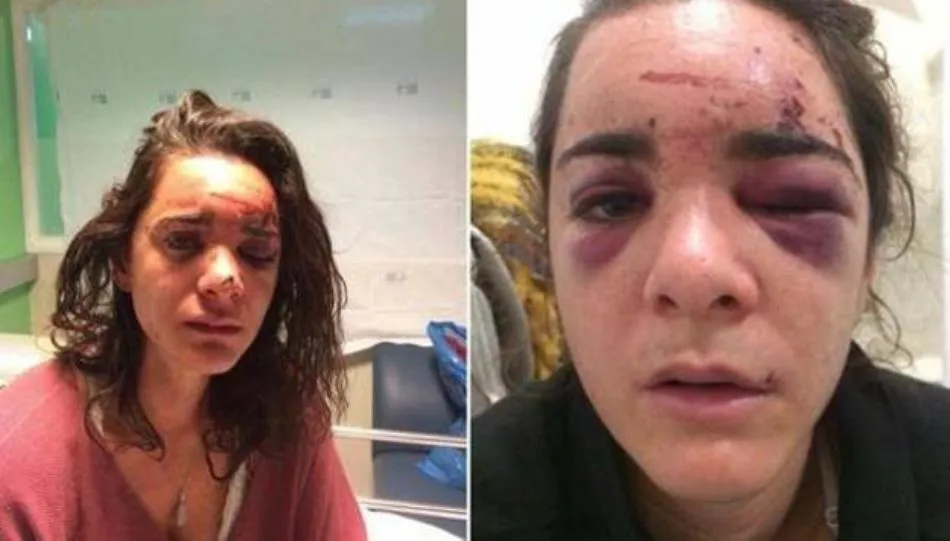 La víctima ha hecho públicas estas fotos en su cuenta de Facebook. Foto El Norte de Castilla