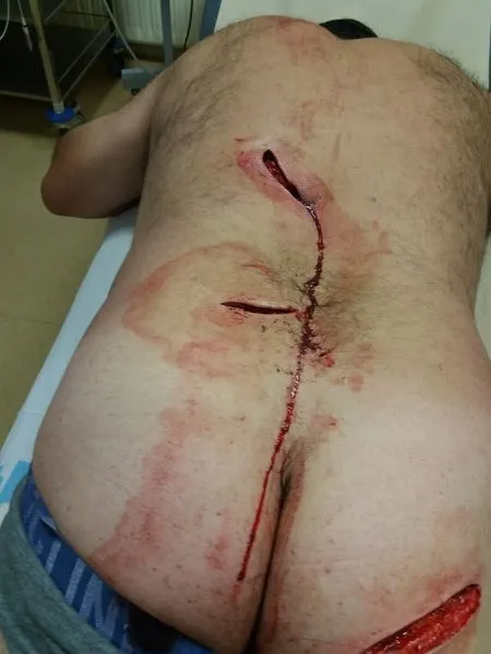 Foto 4 - El ataque de un jabal&iacute; deja importantes heridas al alcalde de Pi&ntilde;uel  