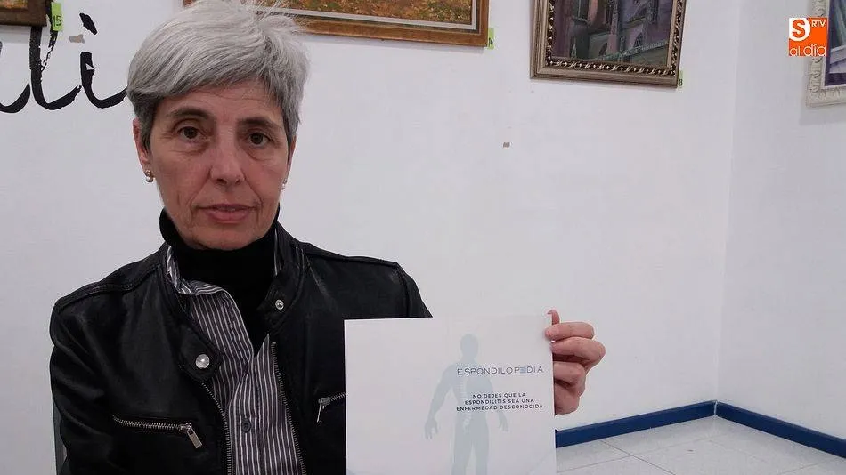 Foto 3 - Los afectados por espondilitis demandan servicios integrales y atenci&oacute;n psicol&oacute;gica  