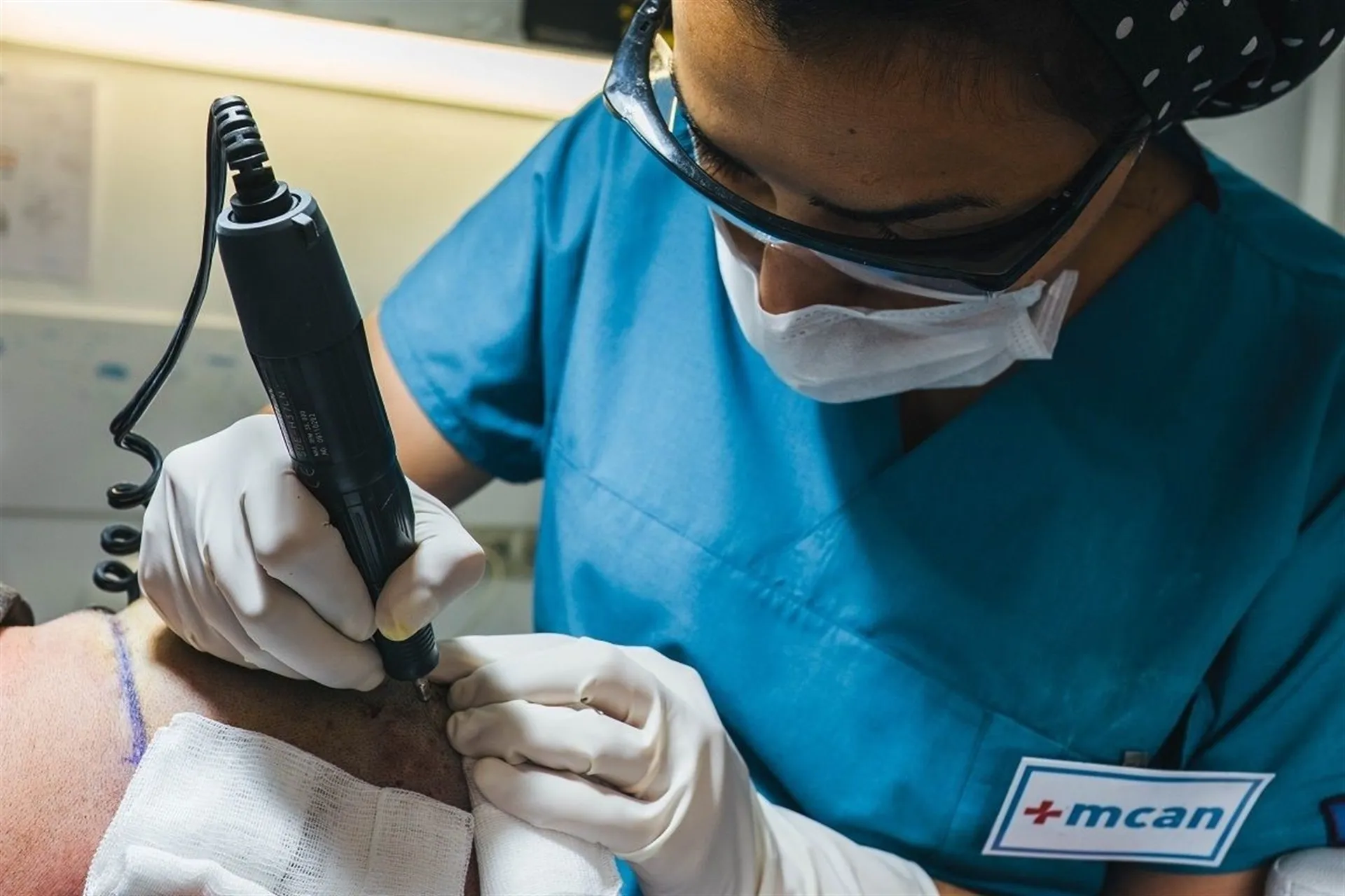 Una trabajadora, en un proceso de transplante capilar / Europa Press