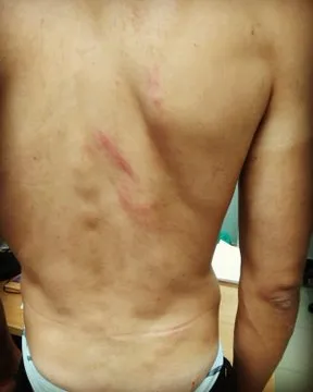 La espalda de Bejarano tras el incidente