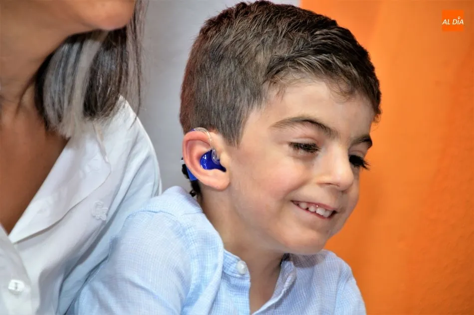 Foto 10 - Pedro, la sonrisa de un ni&ntilde;o con S&iacute;ndrome de Cornelia de Lange  