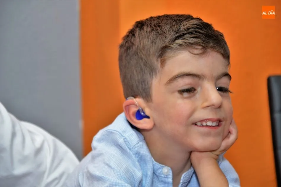 Foto 7 - Pedro, la sonrisa de un ni&ntilde;o con S&iacute;ndrome de Cornelia de Lange  