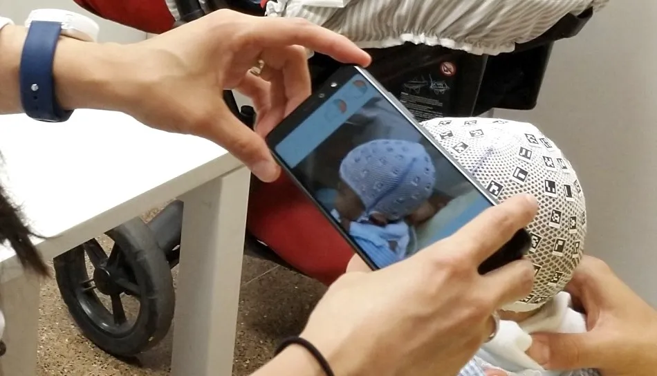 Photomedas ayuda a cuantificar de forma objetiva y de forma muy rápida y sencilla el grado de deformidad craneal. Foto UPV archivo