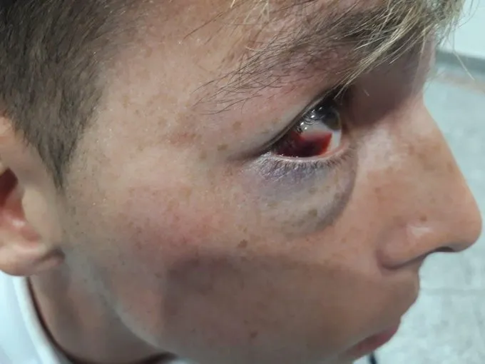 El aspecto de Romero tras el golpe