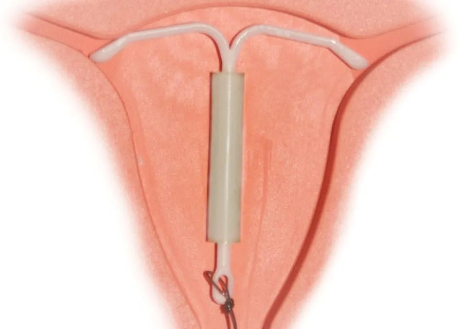 Sanidad alerta de posible rotura en algunos DIUs  