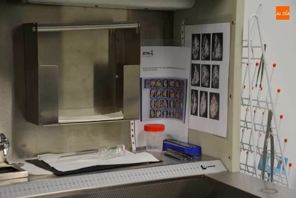 Foto 2 - El banco de cerebros de Salamanca busca nuevos donantes para su labor investigadora
