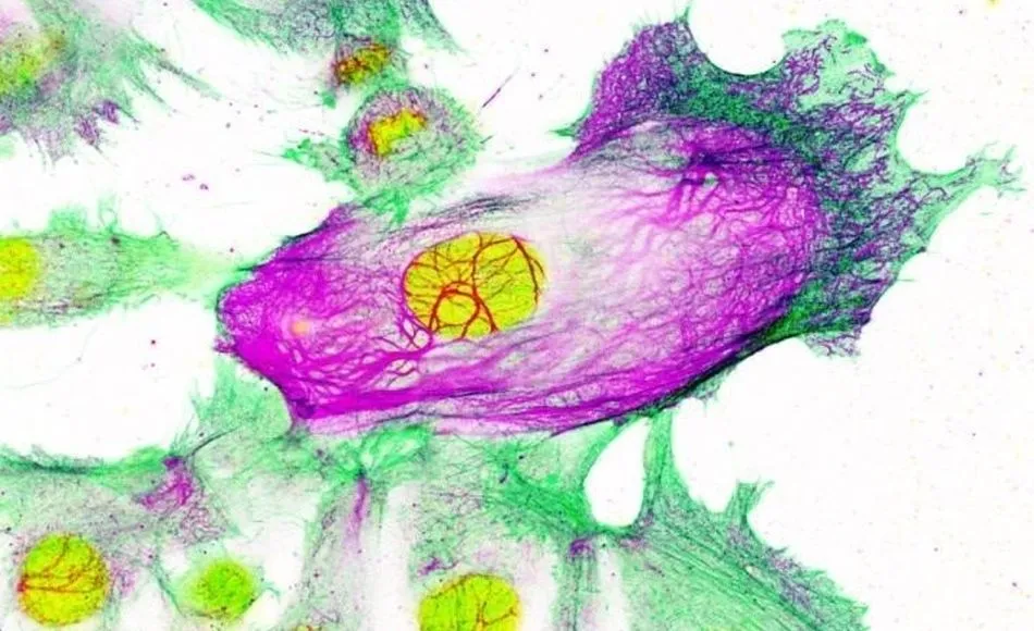 Investigadores del CNIO identifican una posible vía para la prevención de cáncer de mama