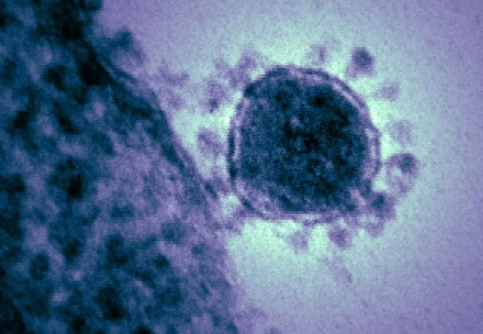 Imagen de archivo de un coronavirus | EP