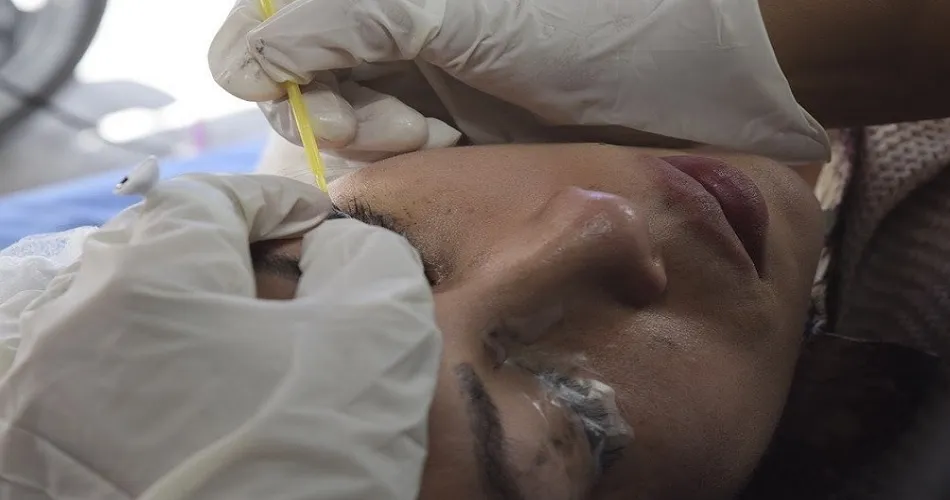 Estética en cejas: micropigmentación y microblading