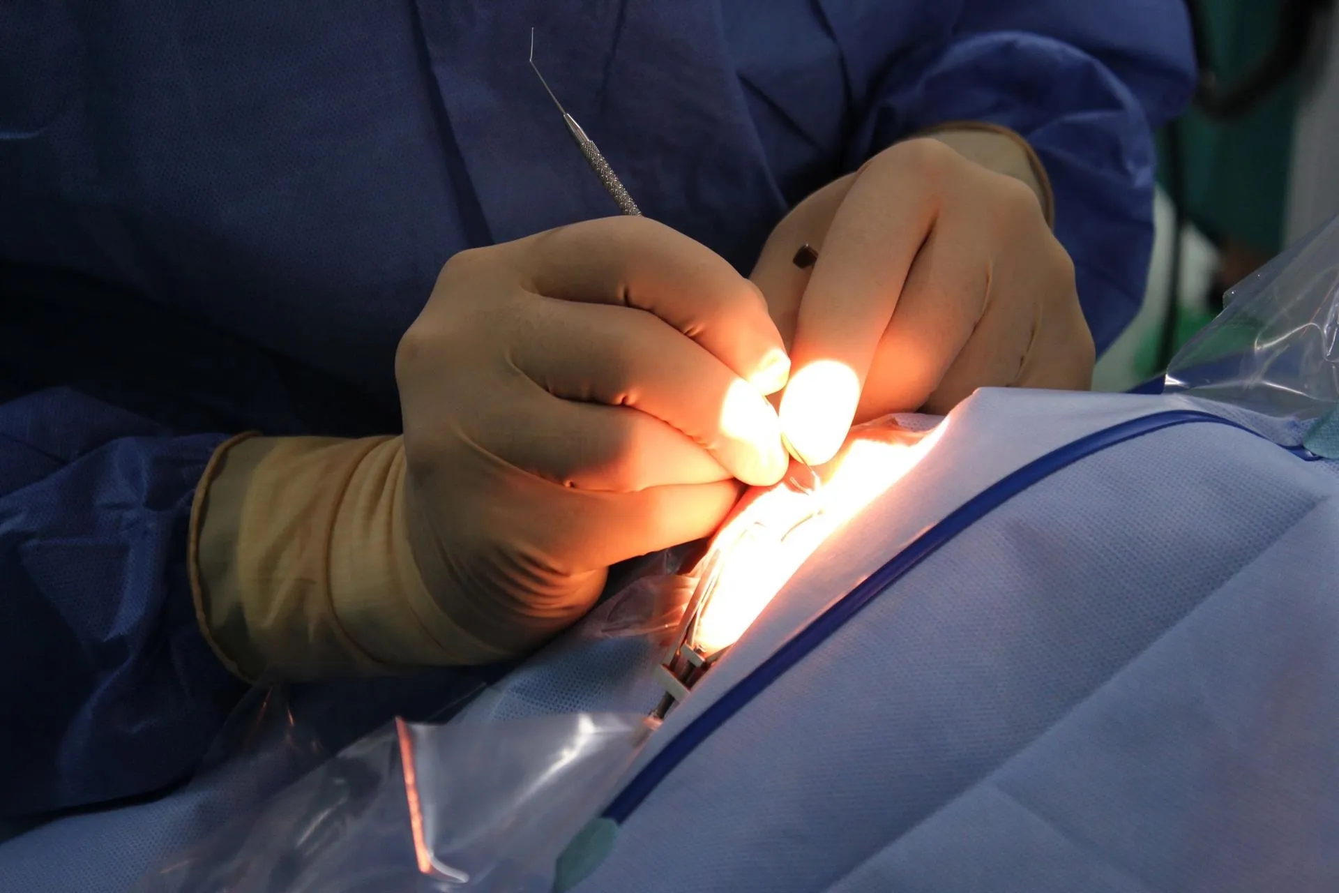 El Tribunal Supremo ha desestimado el recurso de un médico contra una paciente que criticó el tratamiento médico que recibió / Europa Press