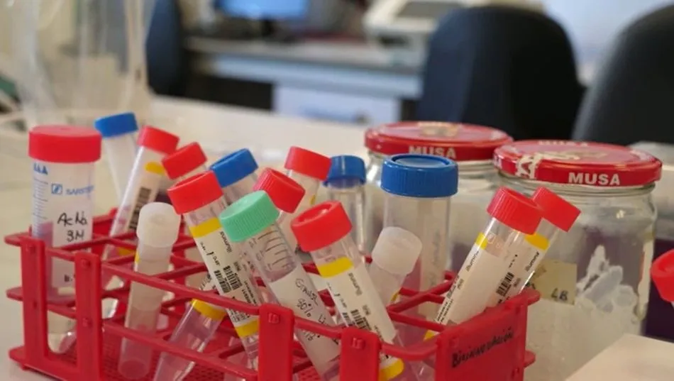 Muestras en la Universidad de Málaga | EP