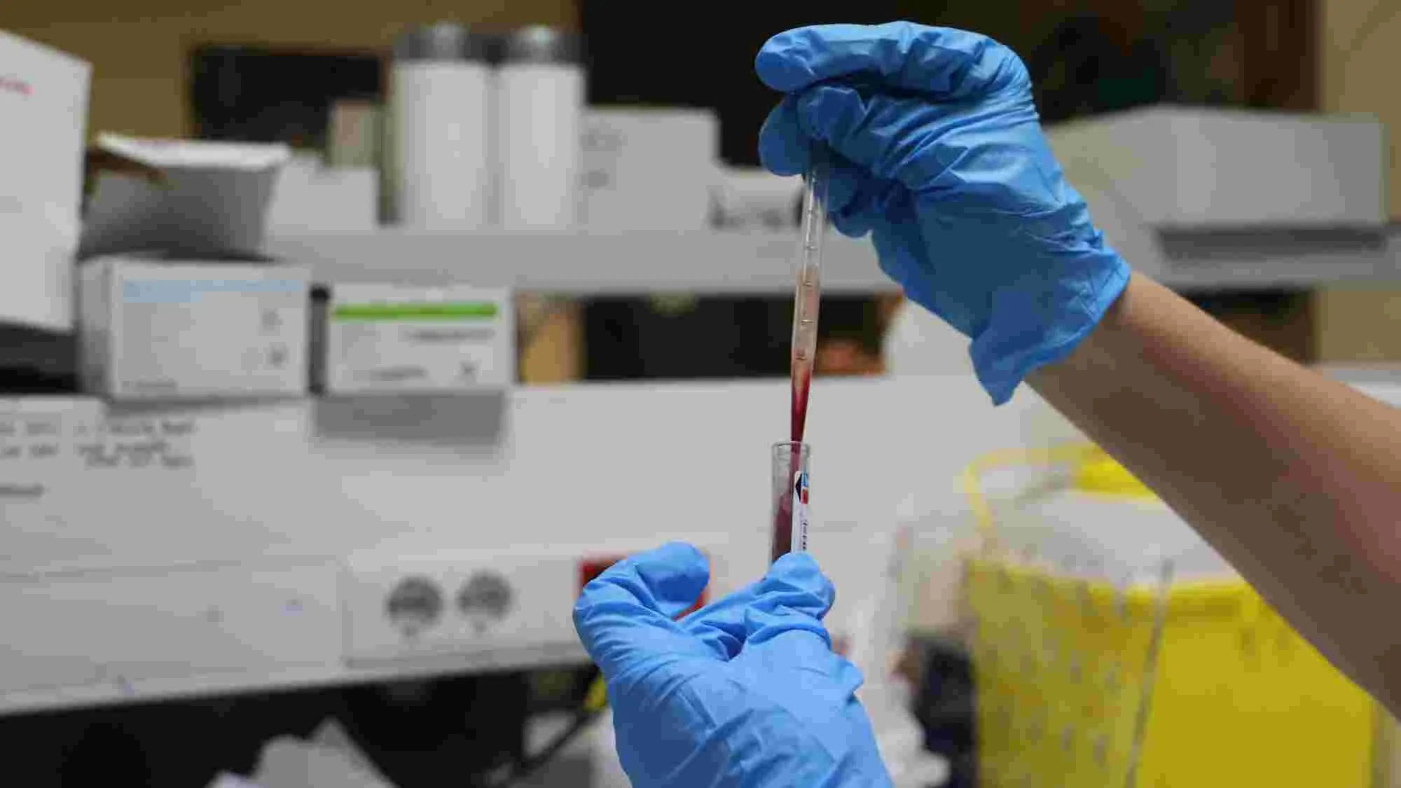 Me mandaron a la planta de posibles casos, sin explicarme cómo poner y quitar el Equipo de...