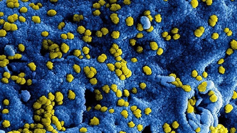 Imagen microscópica electrónica de escaneo digitalmente coloreada (SEM) de las partículas del coronavirus MERS. - NIAID