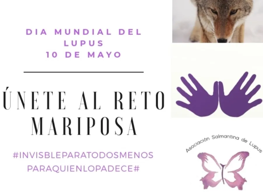 ASALU te invita a participar en el reto mariposa por el Día Mundial del Lupus