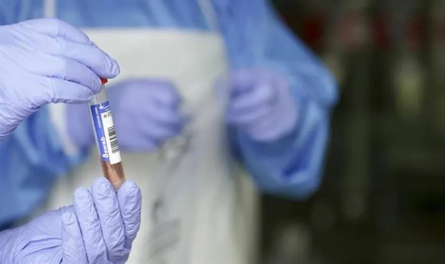 En total, se han diagnosticado ya en la Comunidad 33.331 positivos por COVID-19 en los distintos tipos de pruebas