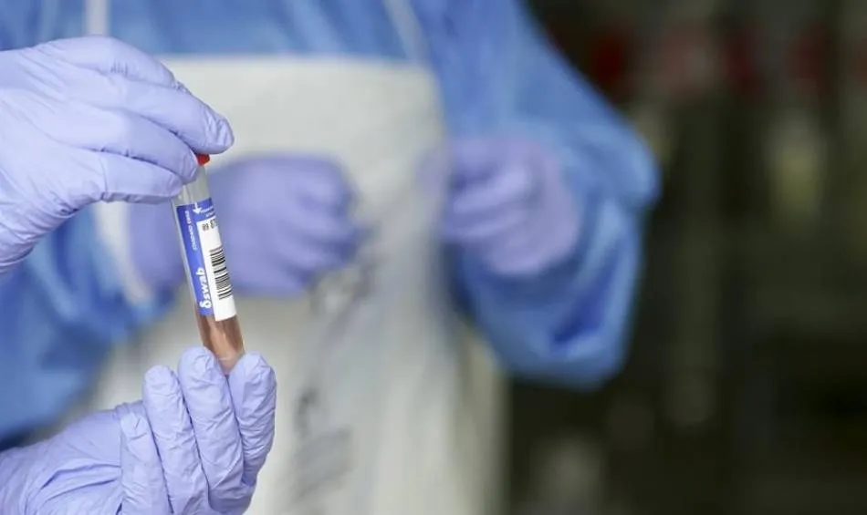 La cifra de PCR realizados en CyL que notifica el Ministerio es inferior en 58.000 a la que publica ...