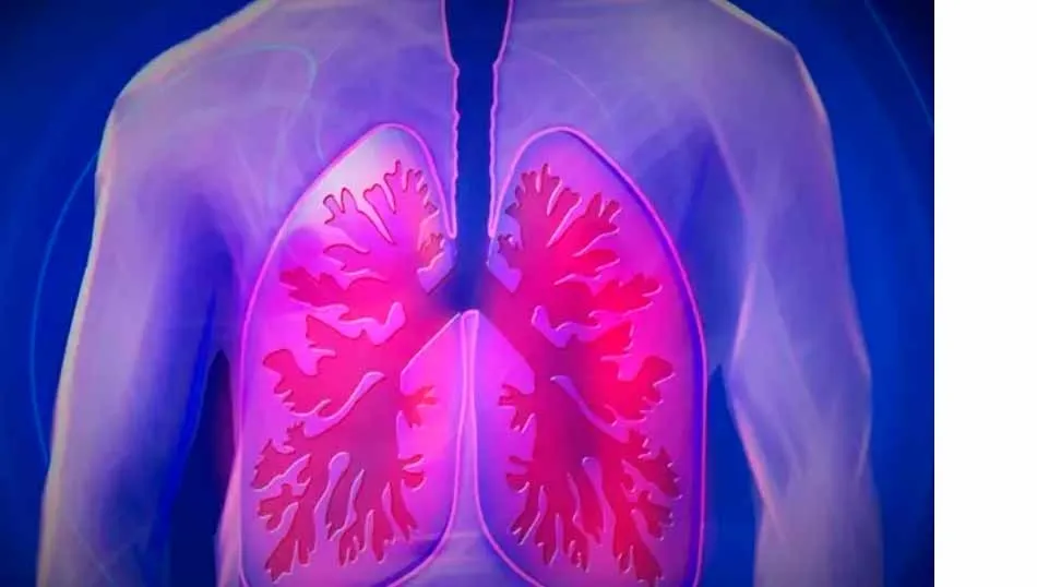 Descubren que el tabaco puede provocar graves problemas respiratorios en pacientes con Covid-19  