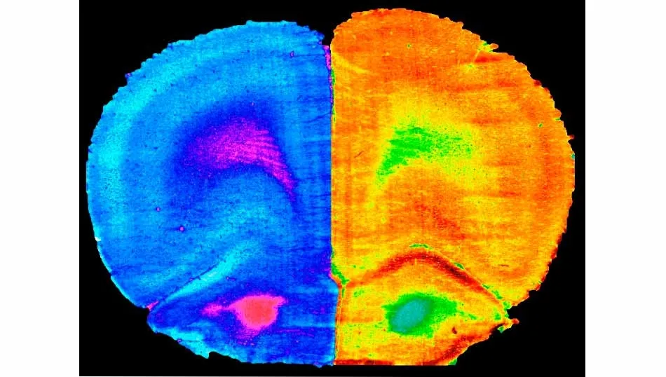Corteza prefrontal de un ratón con la actividad cerebral reducida (izquierda) por una dieta alta en grasas frente a la recuperación con ejercicio o la administración de ‘A. Muciniphila’ (derecha)