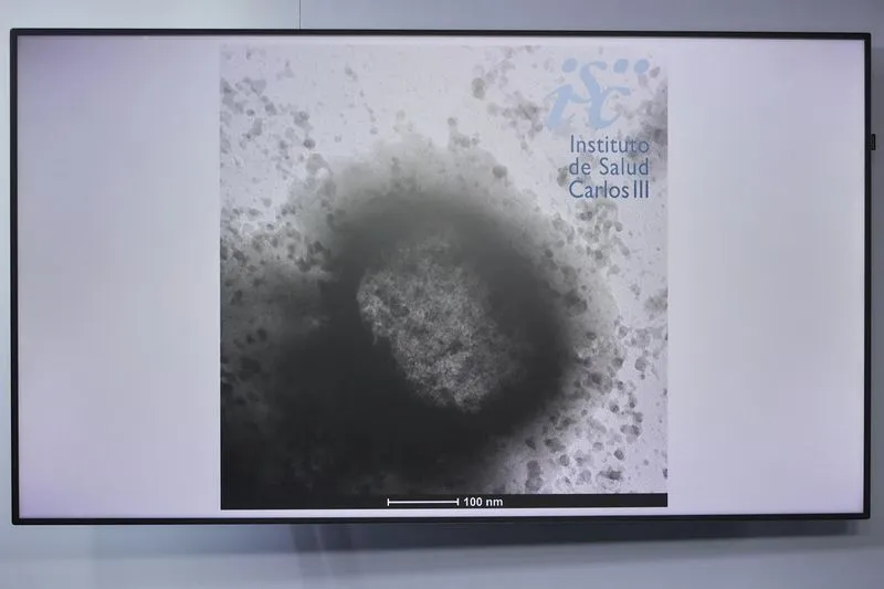 Una molécula de la viruela del mono como resultado de un estudio de la universidad Carlos III. Foto: EP