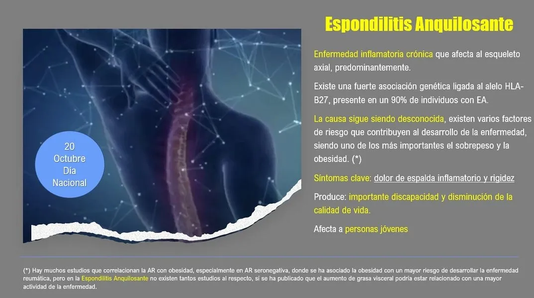 Foto 2 - Desmontando la Espondilitis: &ldquo;No es el colch&oacute;n, no es el sof&aacute;, es tu espalda&rdquo;