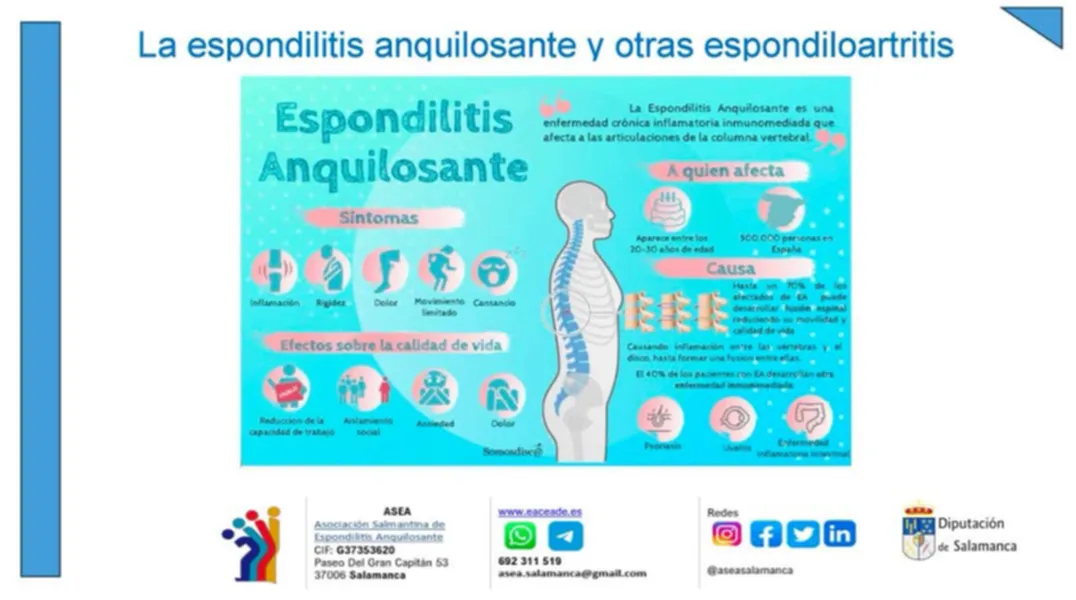 Foto 2 - Desmontando la Espondilitis: unos 2.000 salmantinos padecen esta enfermedad musculoesquel&eacute;tica de origen autoinmune