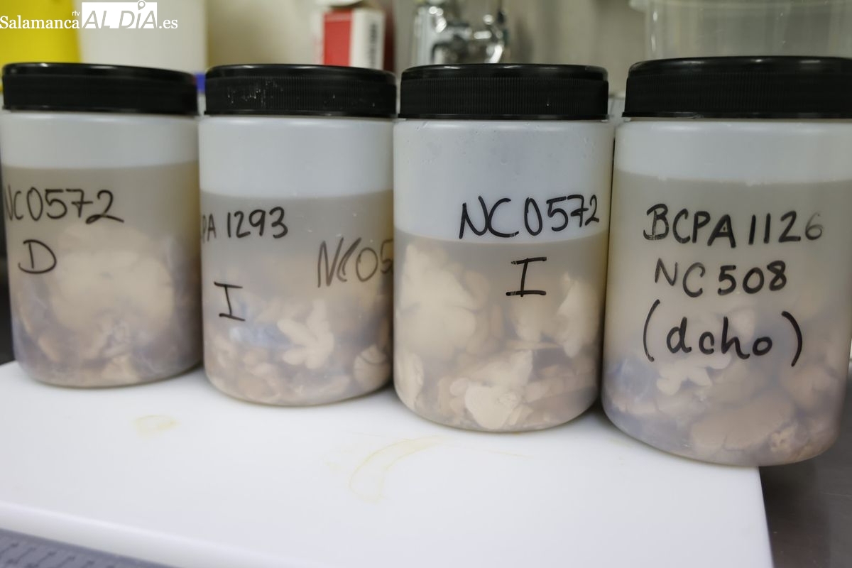 ¿Quién puede donar su cerebro en Salamanca?