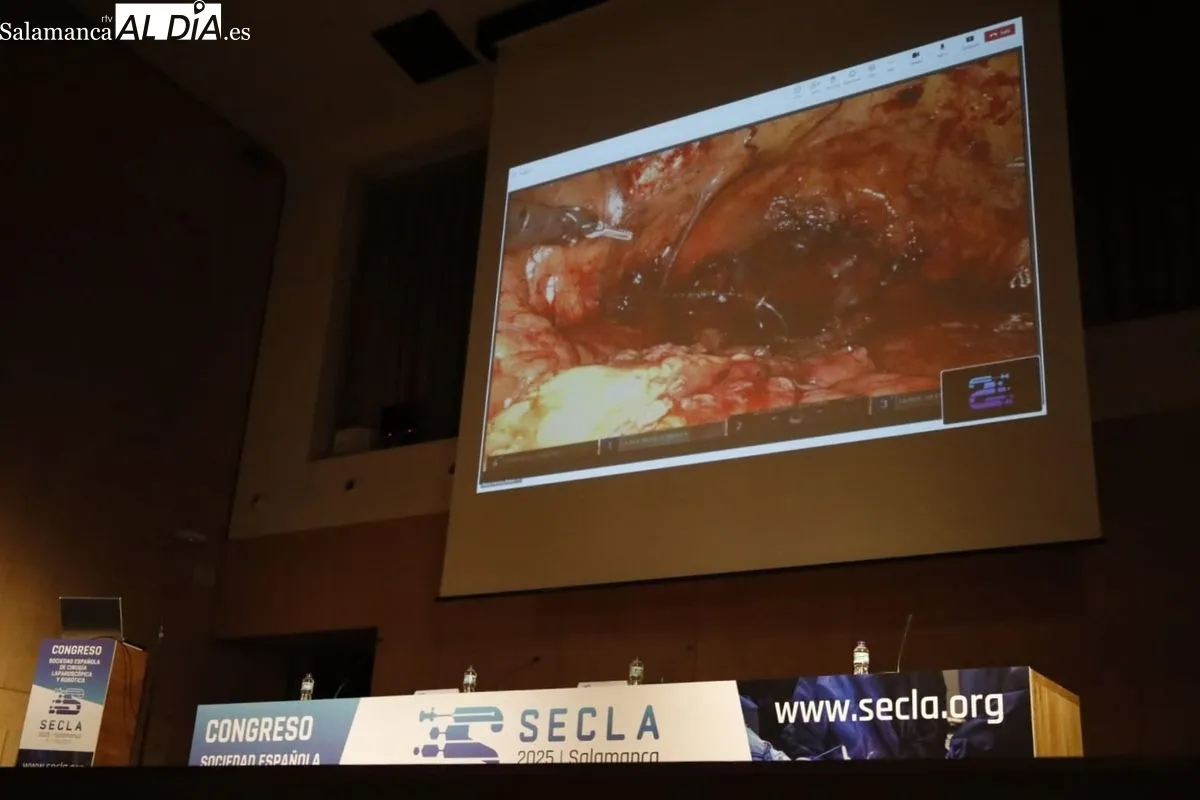 XXI Congreso Nacional de la Sociedad Española de Cirugía Laparoscópica y Robótica (SECLA) en el Colegio y Hospedería del Arzobispo Fonseca, en Salamanca. Foto de David Domínguez