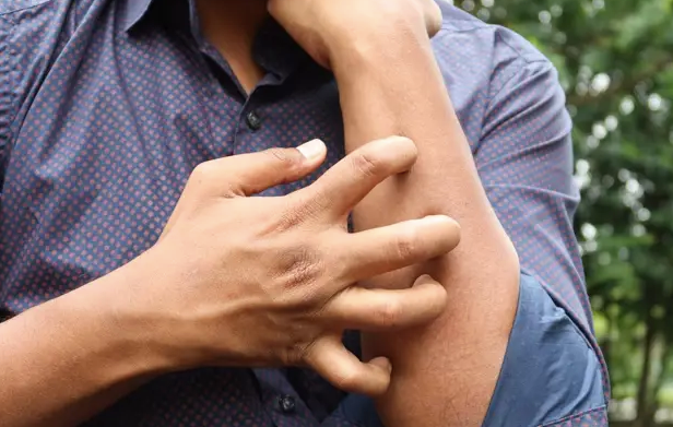 Alergias en verano: por qué aumentan y cómo actuar