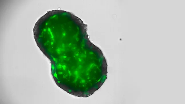 Un estudio liderado desde Salamanca abre una nueva vía para frenar un cáncer de hígado de mal pronóstico