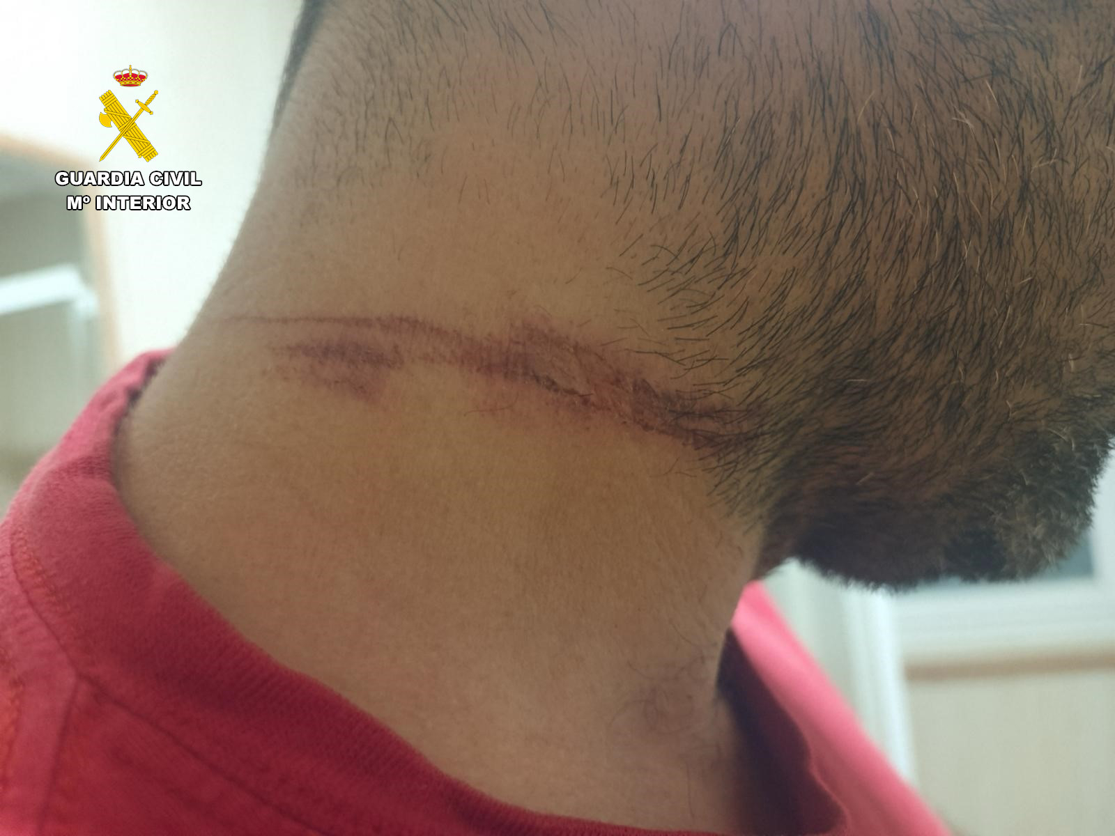 Pastor eléctrico en un camino de Anaya de Alba: un herido