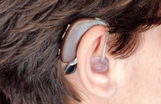 Piden ampliar las ayudas para audífonos a mayores de 26 años