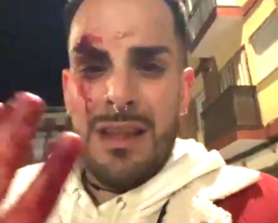 Agresión homófoba en Salamanca: un joven denuncia el ataque