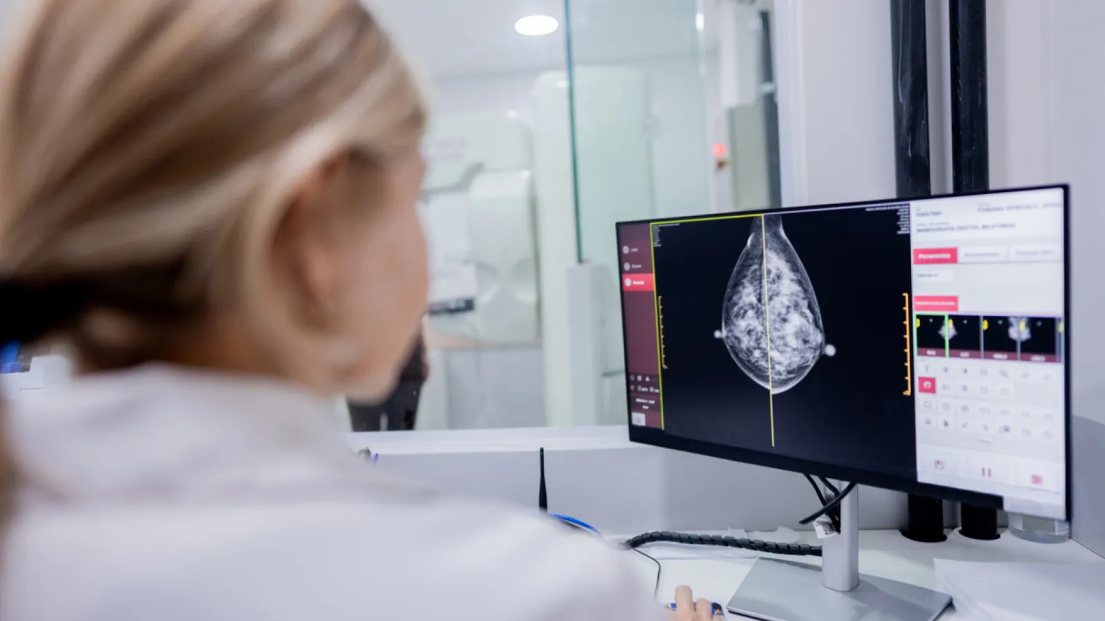 Investigadores de Salamanca descubren que la cabergolina podría reducir el cáncer de mama