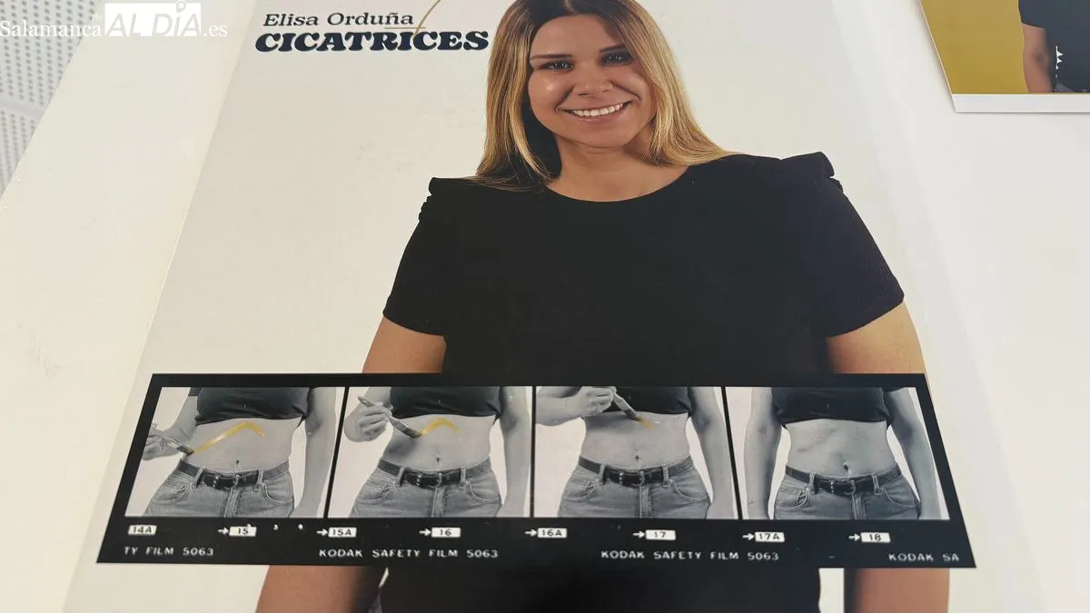 La exposición Cicatrices llega al Hospital de Salamanca