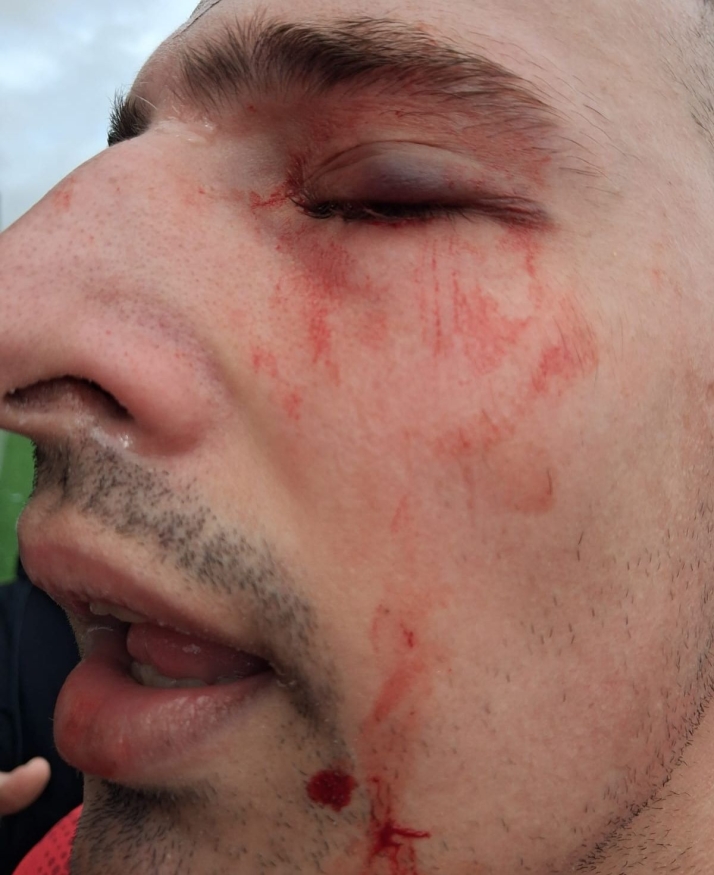 V&Iacute;DEO | El CD Villares niega agresiones de sus jugadores ante el Monterrey y denuncia que uno de sus futbolistas recibi&oacute; un pu&ntilde;etazo en el ojo | Imagen 2