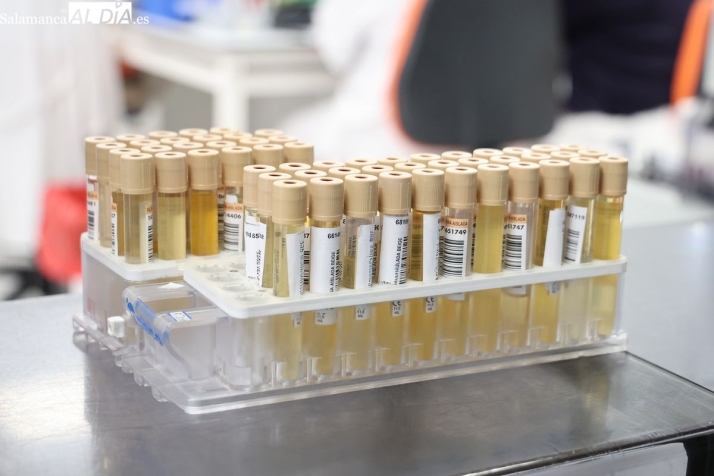 FOTOS | As&iacute; funciona el laboratorio del Hospital de Salamanca: procesa hasta 10.000 muestras biol&oacute;gicas al d&iacute;a y decide el 70% de los diagn&oacute;sticos | Imagen 3
