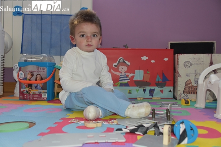 Javi Gallo inicia el tratamiento para mejorar su vida con piel de mariposa: "Esperamos que al niño le suponga menos dolor" | Imagen 1