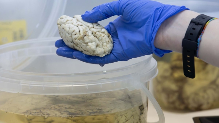 Descubren en Salamanca un 'interruptor' cerebral clave en trastornos como el autismo y la esquizofrenia | Imagen 1