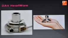 Foto 4 - El Hospital de Salamanca, pionero en Espa&ntilde;a en implantar un ventr&iacute;culo artificial a una mujer de...