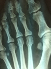 Foto 5 - Clínica del Pie Basas: Profesionalidad y las mejores técnicas para mantener los pies en perfecto...