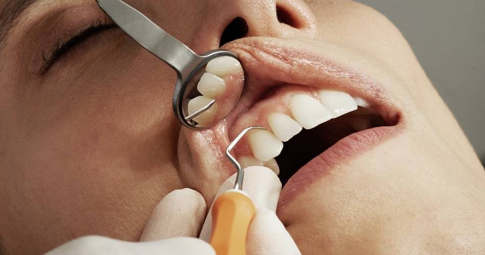 Campaña de los dentistas para prevenir el cáncer oral